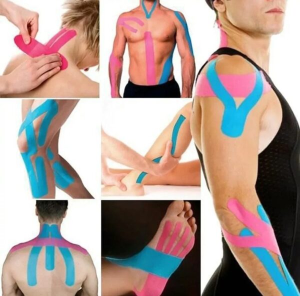 Kinesio Taping
